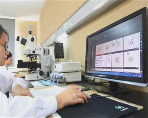 揭示多囊卵巢综合征之谜:掌握这三个标准,轻松识别